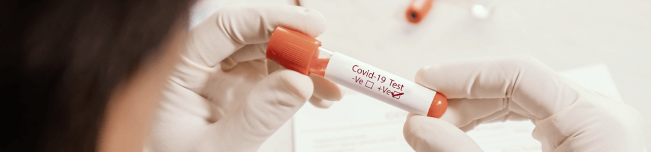develoPPP.de COVID-19 Response